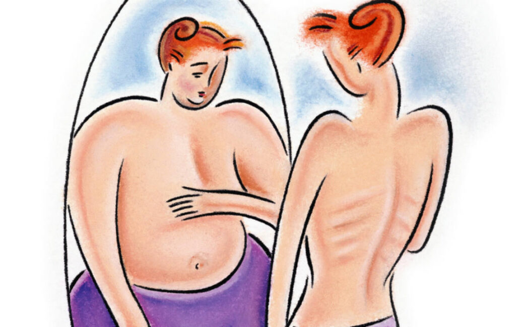 pessoa com anorexia e/ou bulimia se olhando no espelho
